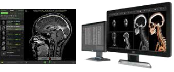 Mobilny dostęp (poprzez Visage EaseSM) obsługiwany przez rozwiązanie Visage 7 (z lewej) i Visage 7 Enterprise Imaging Platform (z prawej). Image courtesy of Visage Imaging Mobilny dostęp (poprzez Visage EaseSM) obsługiwany przez rozwiązanie Visage 7 (z lewej) i Visage 7 Enterprise Imaging Platform (z prawej). Image courtesy of Visage Imaging