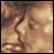 NVIDIA and Philips: Ultrasound Imaging For Medical Diagnosis