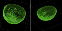 Rendering wolumetryczny w systemie TechniScan Whole Breast Ultrasound.
