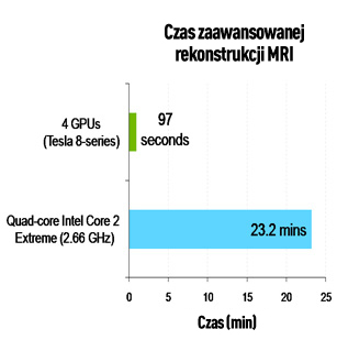 MRI Chart
