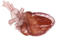 Heartworks Heartworks